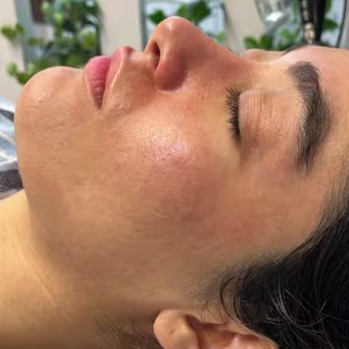 بعد از فیشال تخصصی